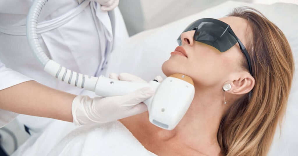 depilación laser correcta